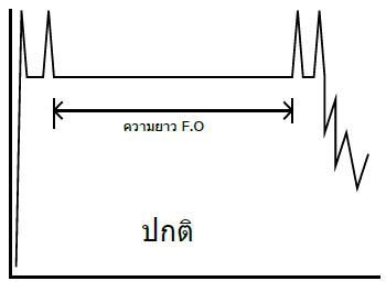 การดูค่า loss ในเคเบิลใยแก้วนำแสง (Fiber optic)